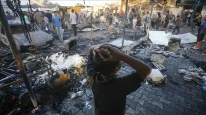 Viral Sandera Israel Kurus Kering di Gaza